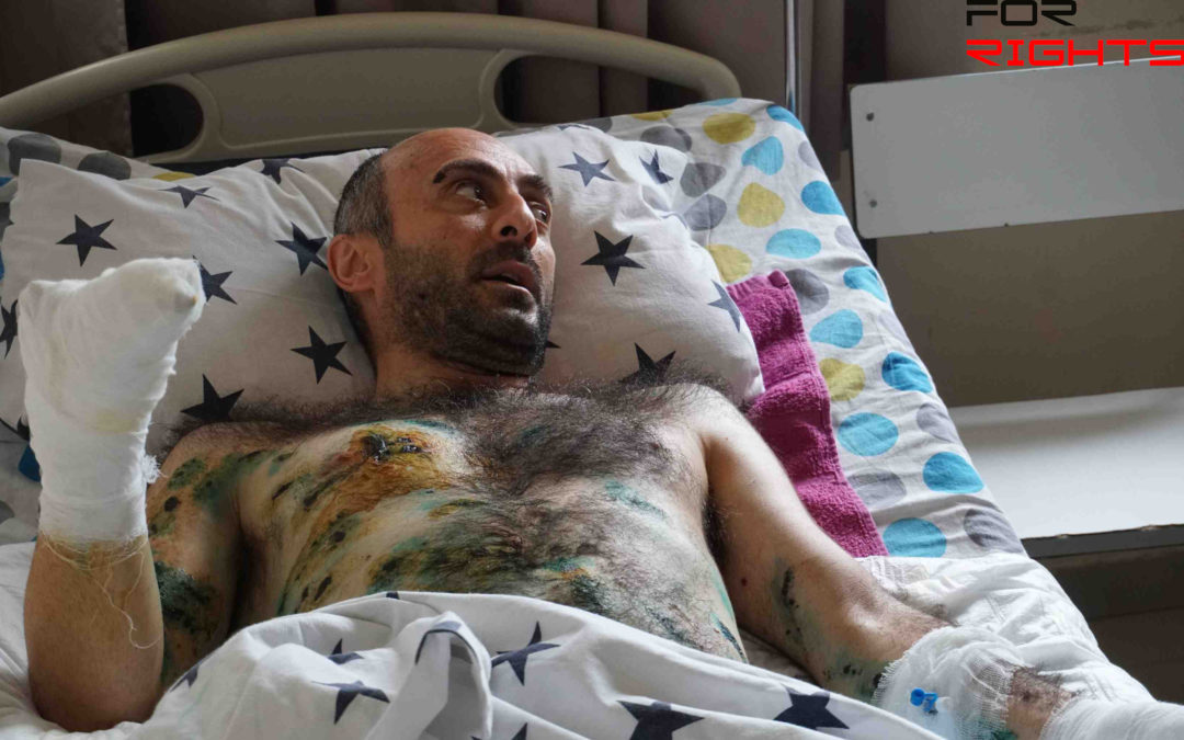Yesayi Karamyan, who received the most severe injuries from the special measures used by the police, was recognized as a victim